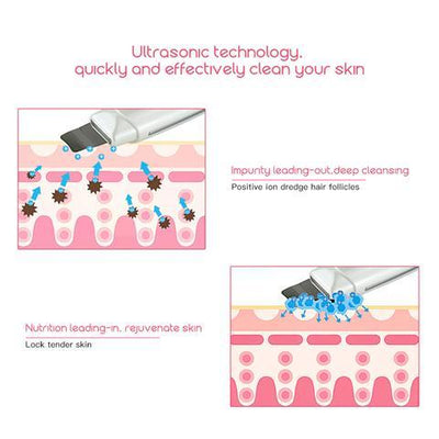 Ultrasonic Skin Scrubber & Facial Cleanser for Blackhead and Acne Removal